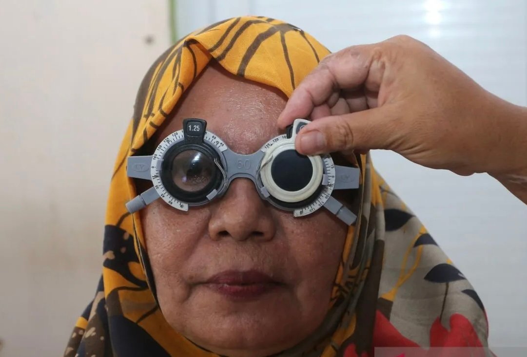 Ingin Terhindar dari Katarak? Gunakan Kacamata Anti-UV Saat Beraktivitas